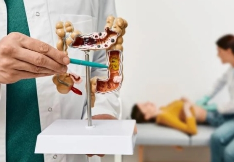 Những ai có nguy cơ cao mắc ung thư đại tràng và cần tầm soát sớm?